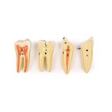 Mandibula modell 6 részes