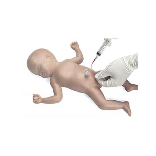 Baby Umbi köldökkatéter behelyezése