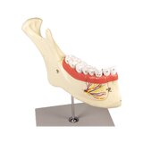 Mandibula modell 6 részes