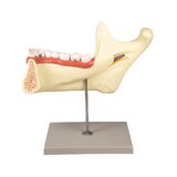 Mandibula modell 6 részes