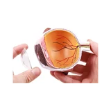 A szem fele, megnagyobbodott