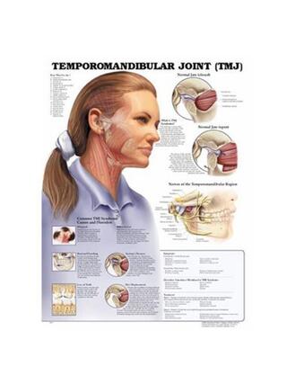 Temporomandibuláris ízületi rendellenesség (TMJ) laminált angol