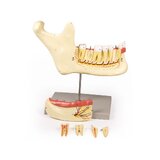 Mandibula modell 6 részes